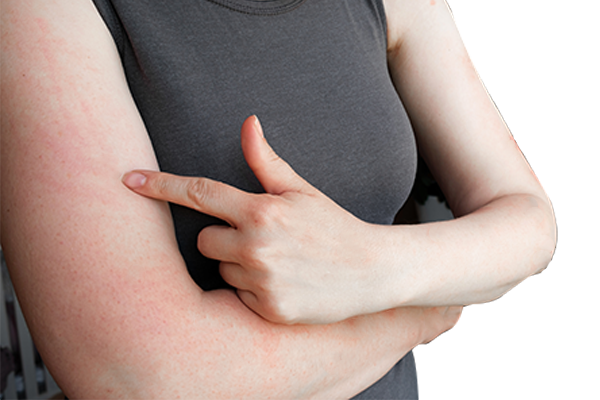 LaPiel_Skin_Infection_After