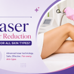 laser hair reduction